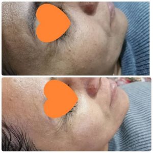 محصولات پاکسازی پوست دایموند اصفهان ✅ فروش محصولات پاکسازی برای کلینیک ها و سالن های زیبایی ✅ ارائه محصولات ارگانیک پوست جهت انجام فیشیال که شامل پیلینگ، محلول اسید تراپی، پیلینگ آنزیمی ، ماسک الاستیک، ماسک گچی،ماسک ژله و شاین، ماسک کرم، ژل آبرسان ، کرم ماساژ ، محلول بخور، سرم می باشد. شما می توانید برای مشاهده میزان رضایتمندی مشتریان همیشگی ما و مشاهده نظرات مصرف کنندگان محصولات به پیج اینستاگرام  @organic_product_diamond مراجعه کنید.
